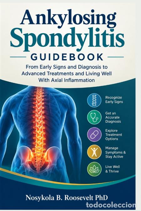 books: Ankylosing Spondylitis Guidebook - Nosykola B. Roosevelt PhD