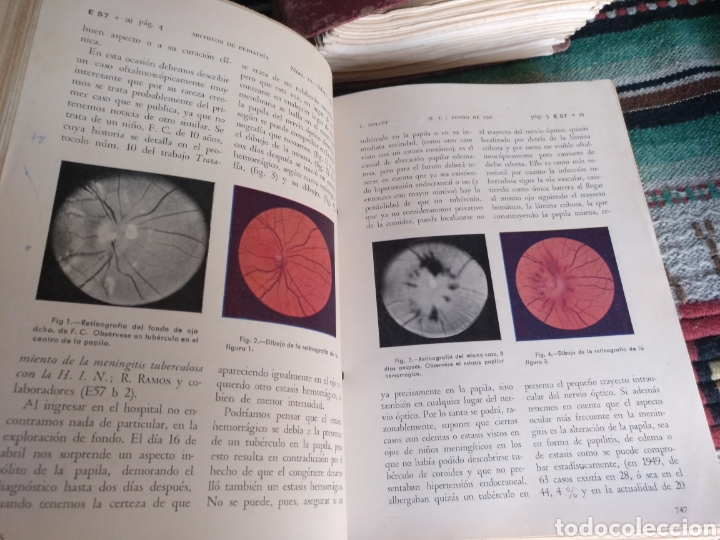 Libros: Archivos de pediatría años 50 y 60 - Foto 36 - 176636158