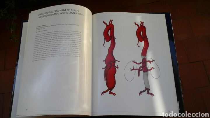 Libros: AORTIC SURGERY - Foto 2