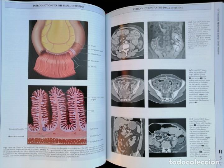 Libros: DIAGNOSTIC IMAGING – ABDOMEN - Foto 8 - 285052583