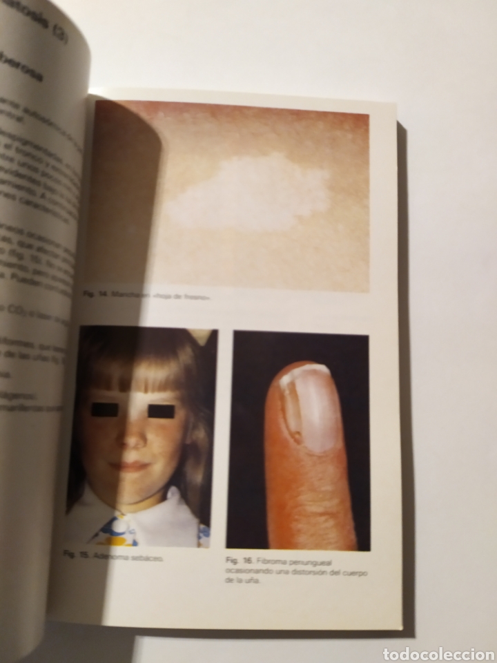 Libros: LIBRO DERMATOLOG&Iacute;A - Foto 5