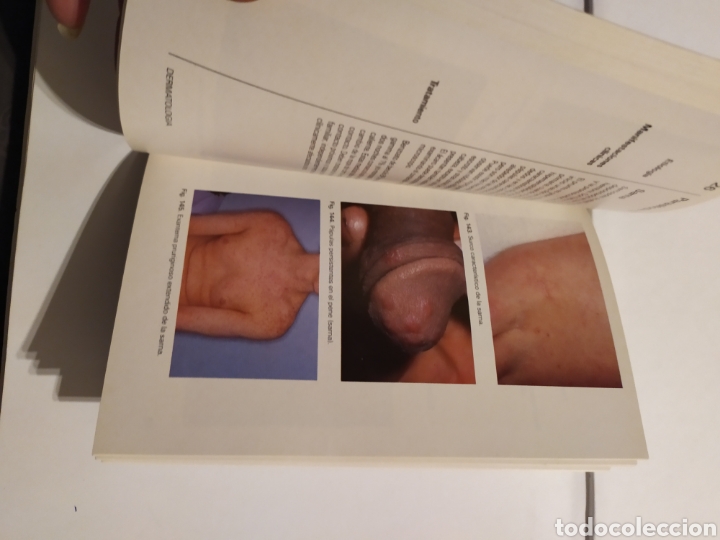 Libros: LIBRO DERMATOLOG&Iacute;A - Foto 7