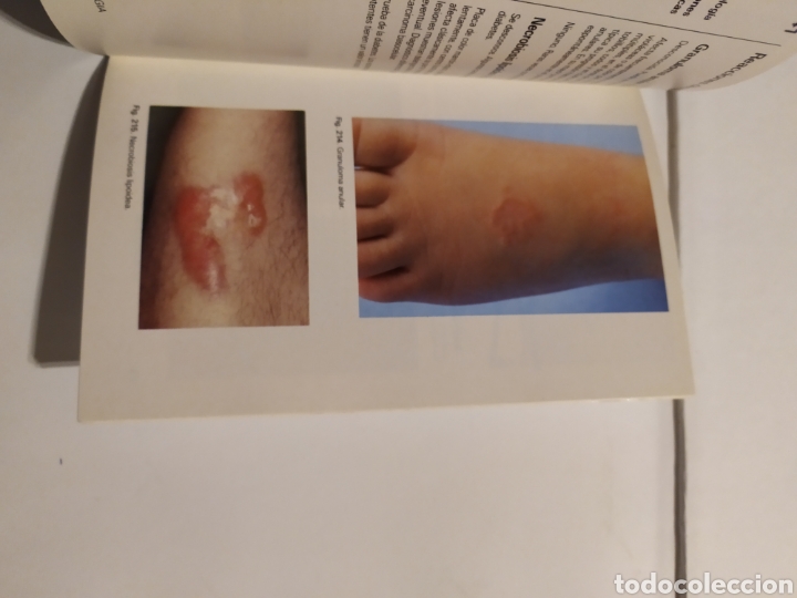Libros: LIBRO DERMATOLOG&Iacute;A - Foto 8