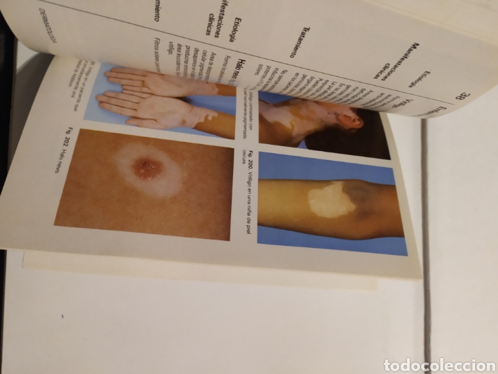 Libros: LIBRO DERMATOLOG&Iacute;A - Foto 9