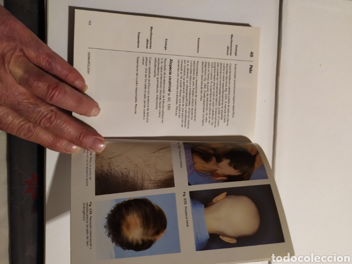 Libros: LIBRO DERMATOLOG&Iacute;A - Foto 10