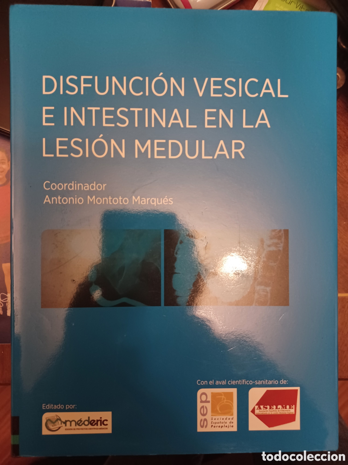 Libros: Disfuncion vesical e intestinal en la lesi&oacute;n medular - Foto 1