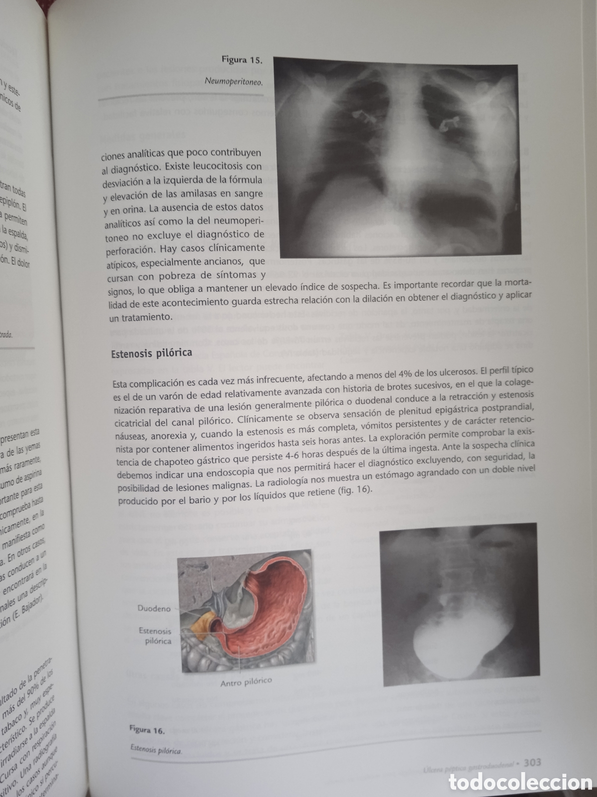 Libros: Principios B&aacute;sicos de Gastroenterolog&iacute;a - Foto 4