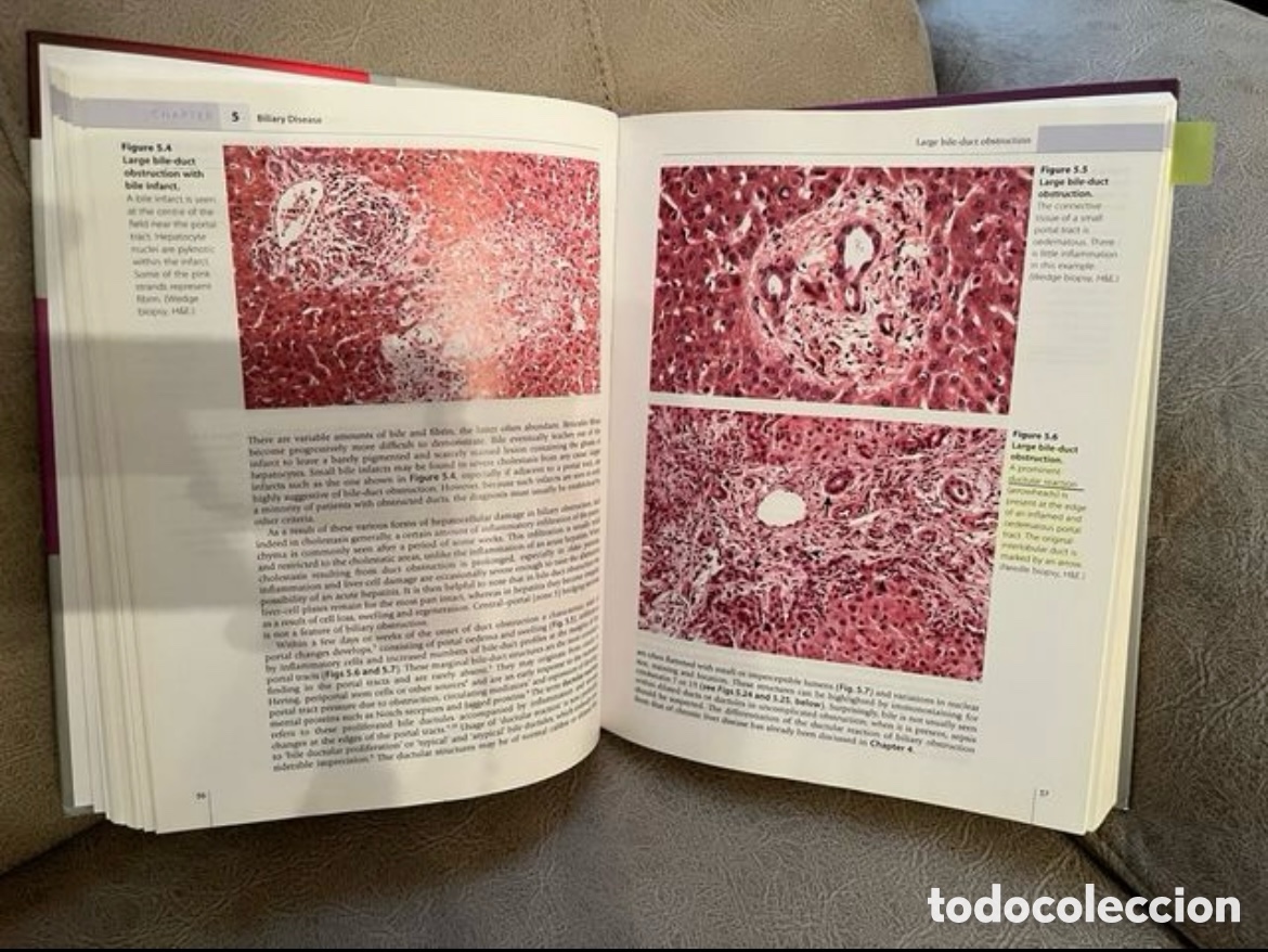 Libros: Scheuers Liver Biopsy Interpretation - Foto 2