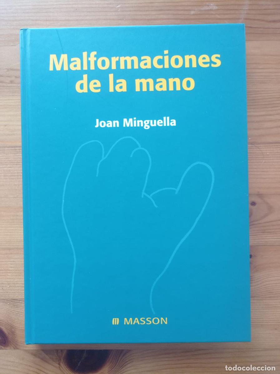 Libros: Malformaciones de la mano J. Minguella - Foto 1