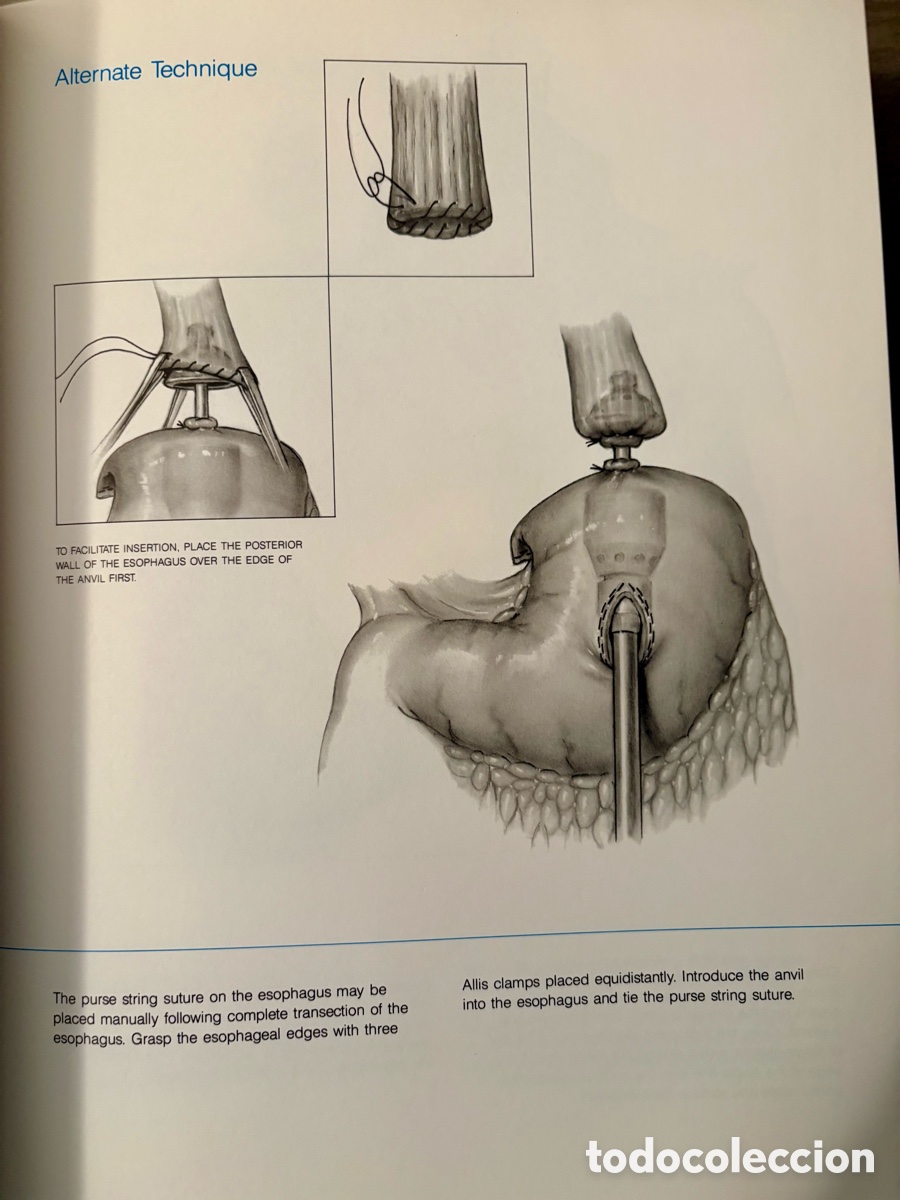 Libros: Stapling Techniques General Surgery 1988 - Foto 6