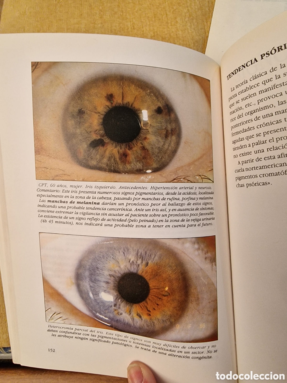 Libros: Iridologia de Josep Luis Berdonces - Foto 6