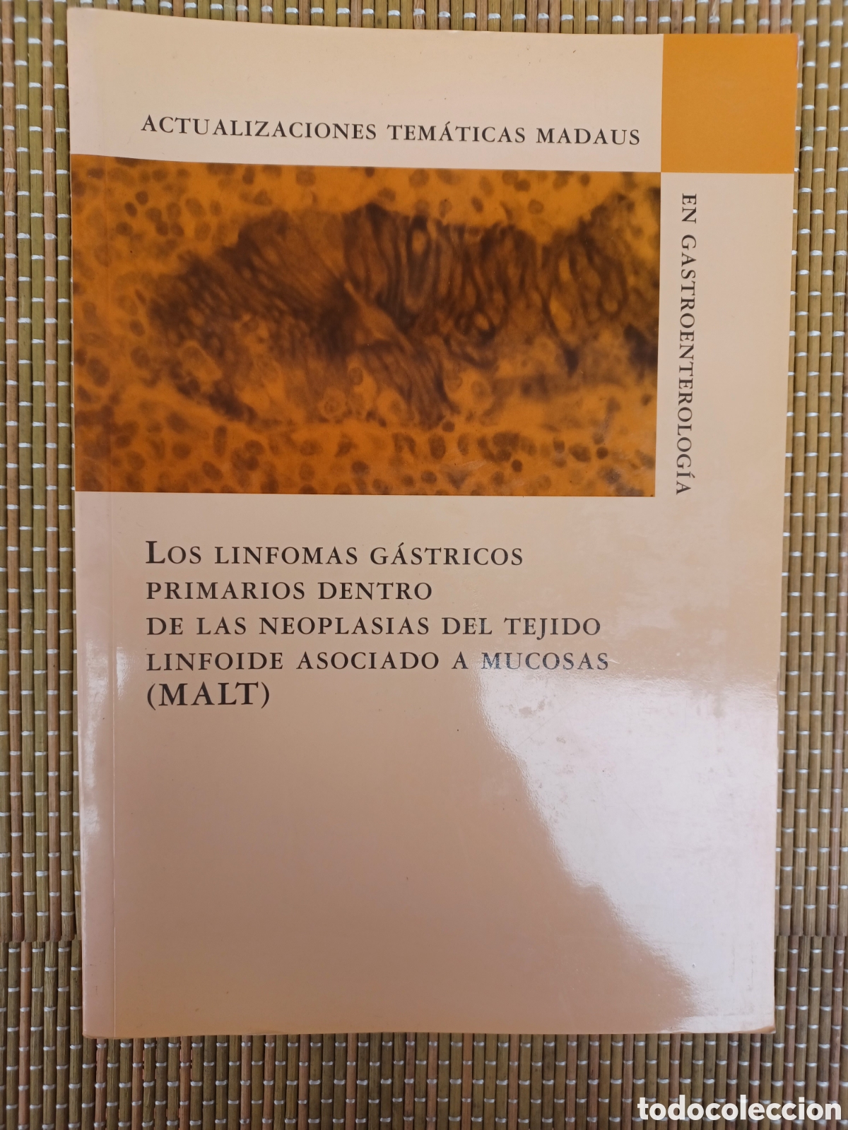 Libros: Linfomas g&aacute;stricos primarios MALT. Actualizaciones tem&aacute;ticas Madaus