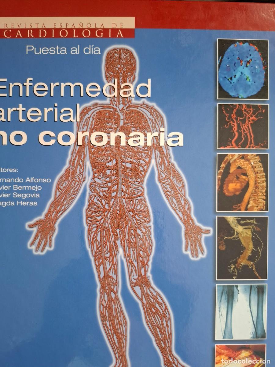 Libros: enfermedad arterial no coronaria vv aa