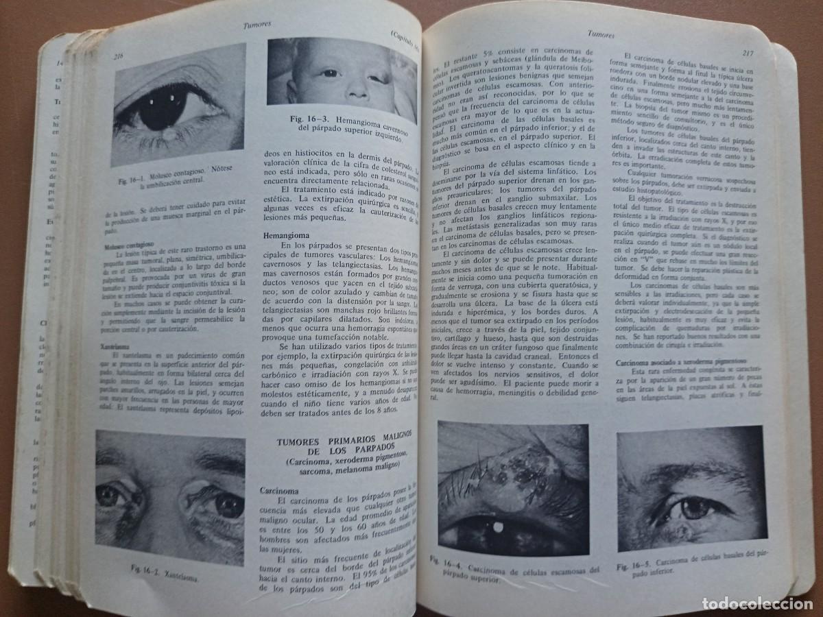 Libros: OFTALMOLOG&Iacute;A GENERAL- 3&ordf; EDICI&Oacute;N - Foto 13