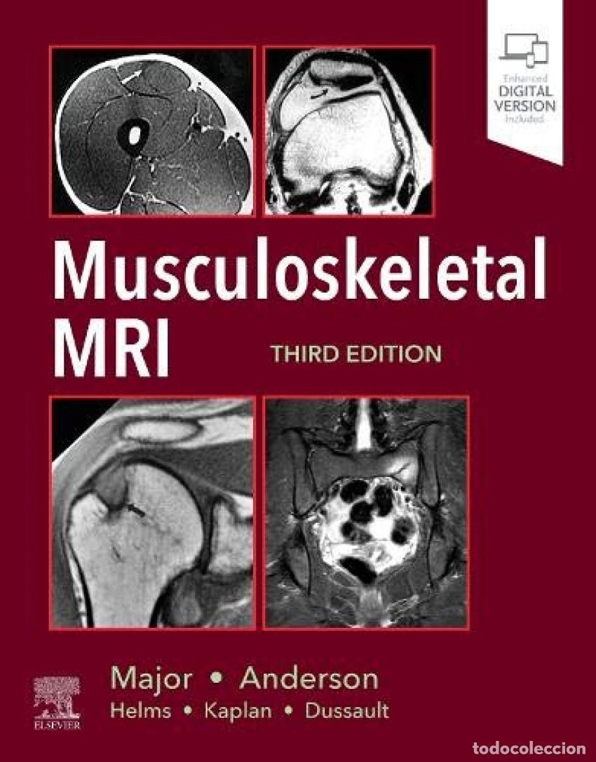 Livros: MUSCULOESKELETAL MRI - Major