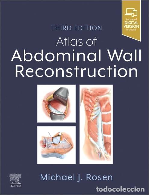 Livres: ATLAS OF ABDOMINAL WALL RECONSTRUCTION - Rosen
