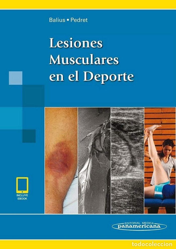 Livros: LESIONES MUSCULARES EN EL DEPORTE (INCLUYE EBOOK) - BALIUS MATAS, RAMON