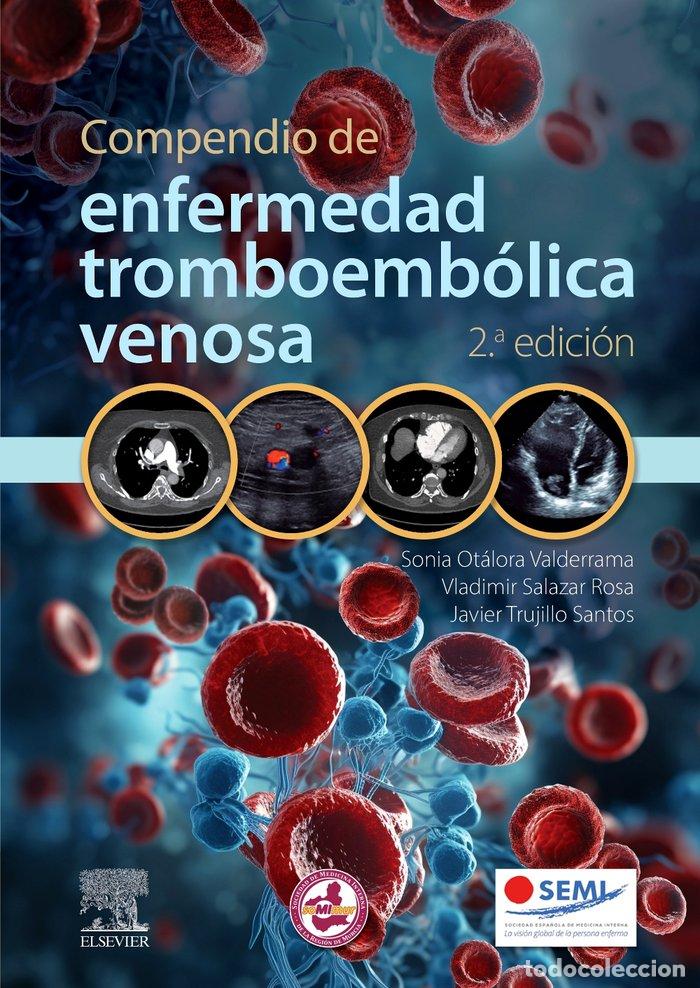 Livres: COMPENDIO DE ENFERMEDAD TROMBOEMBOLICA VENOSA 2&ordf; ED - OTALORA