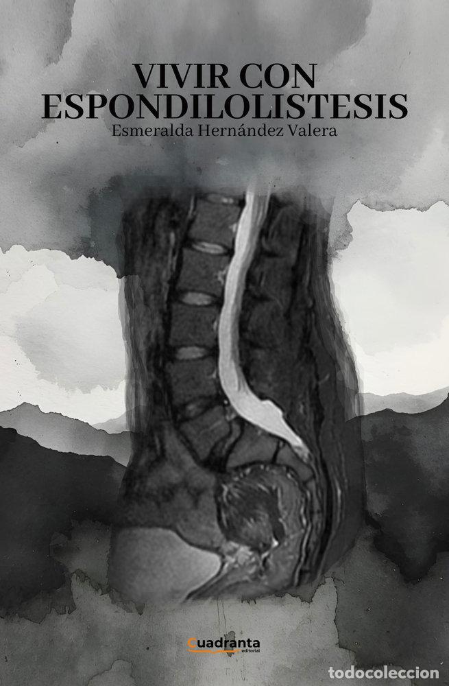 books: VIVIR CON ESPONDILOLISTESIS - HERNANDEZ VALERA, ESMERALDA