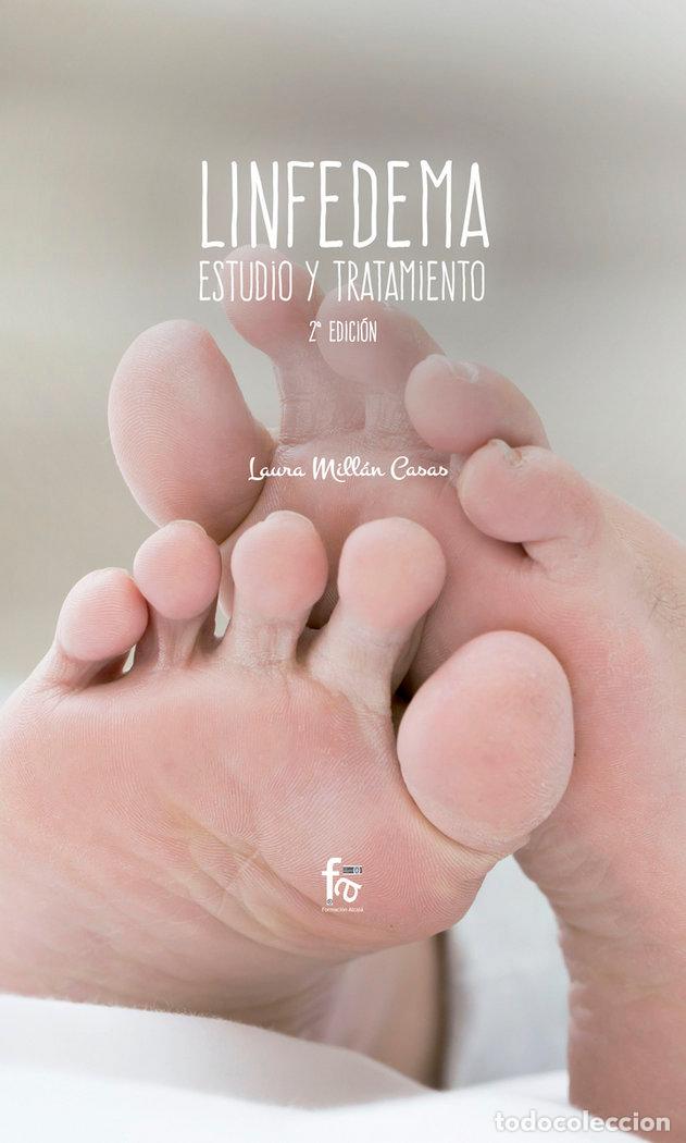 Livres: LINFEDEMA ESTUDIO Y TRATAMIENTO 2&ordf;ED - MILLAN CASAS, LAURA