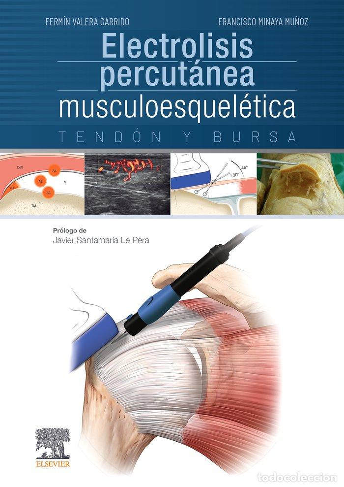 Libros: ELECTROLISIS PERCUTANEA MUSCULOESQUELETICA. TENDON Y BURSA - VALERA GARRIDO, FERMIN