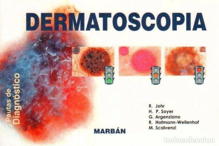 Libri: DERMATOSCOPIA. PAUTAS DE DIAGNOSTICO - VARIOS