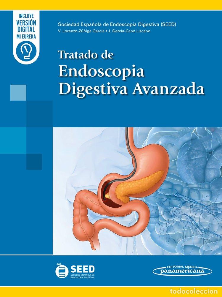 B&uuml;cher: TRATADO DE ENDOSCOPIA DIGESTIVA AVANZADA - LORENZO-ZU&Ntilde;IGA, VICENTE