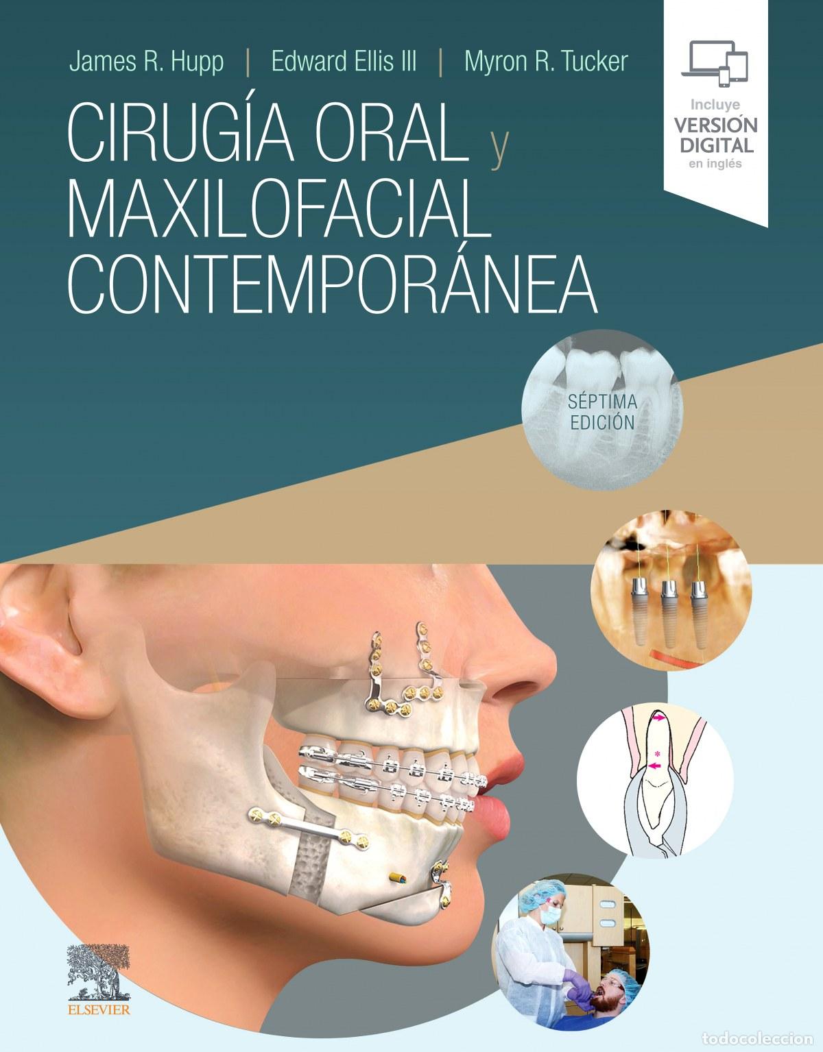 B&uuml;cher: CIRUG&Iacute;A ORAL Y MAXILOFACIAL CONTEMPOR&Aacute;NEA (7&ordf; ED.) - Hupp, James R