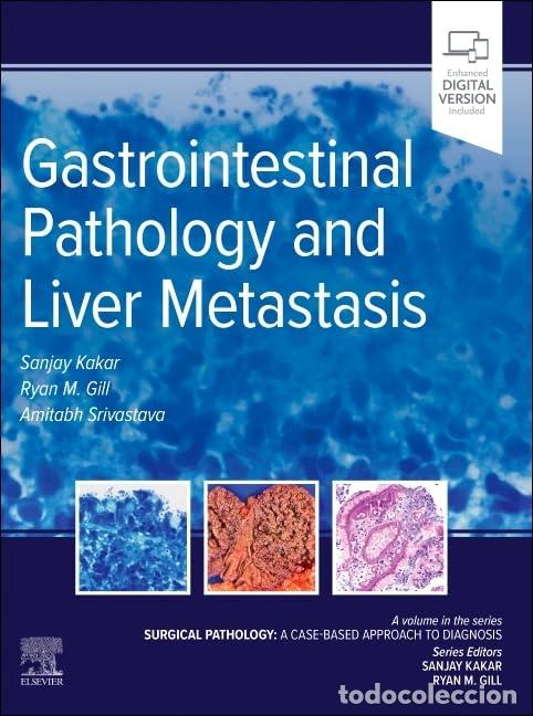 Livres: GASTROINTESTINAL PATHOLOGY AND LIVER METASTASIS - Kakar, Sanjoy