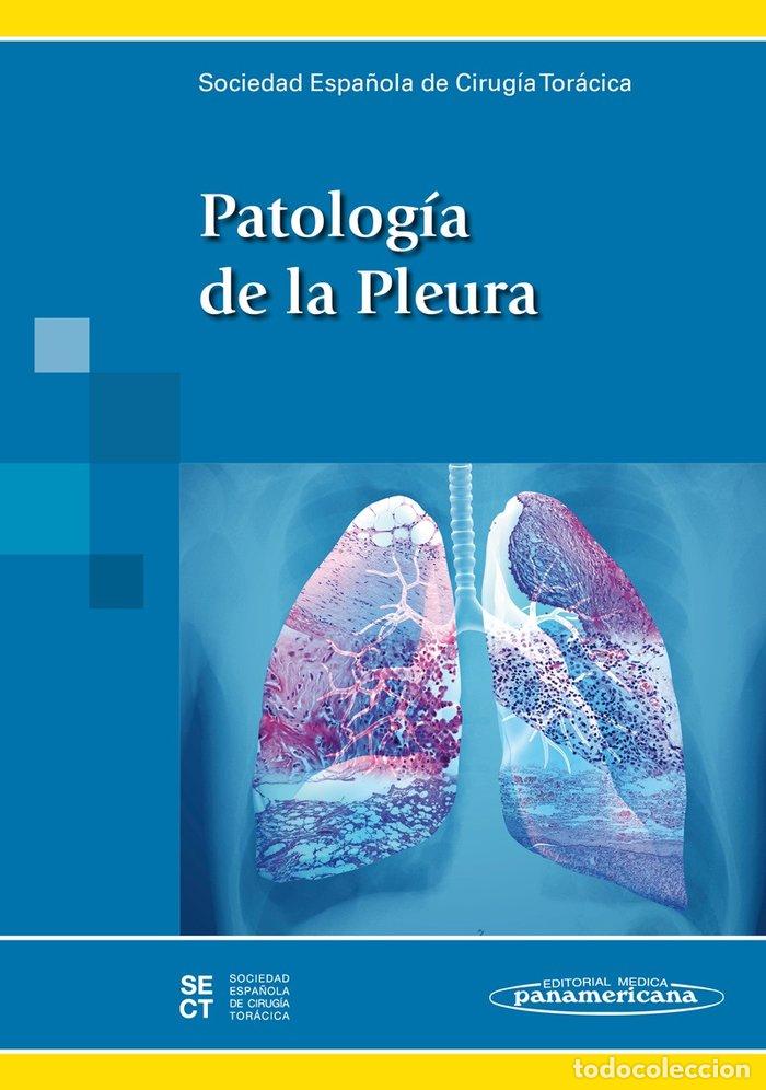 Libri: PATOLOGIA DE LA PLEURA - SOCIEDAD ESPA&Ntilde;OLA DE CIRUGIA TORACICA