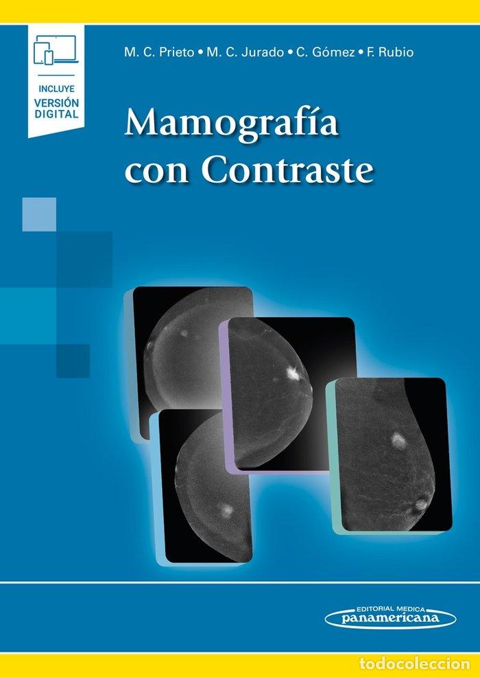 Libros: MAMOGRAFIA CON CONTRASTE - PRIETO