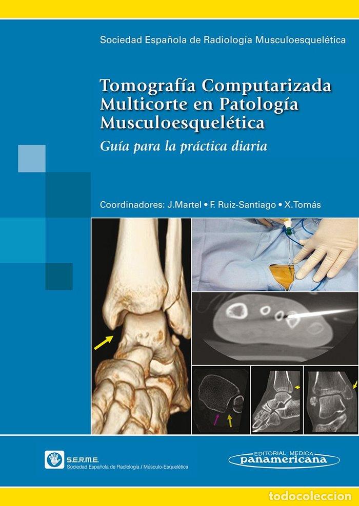 Libri: TOMOGRAFIA COMPUTARIZADA MULTICORTE EN PATOLOGIA MUSCULOESQU - SERME SOCIEDAD ESPA&Ntilde;OLA DE RADIOLOGIA