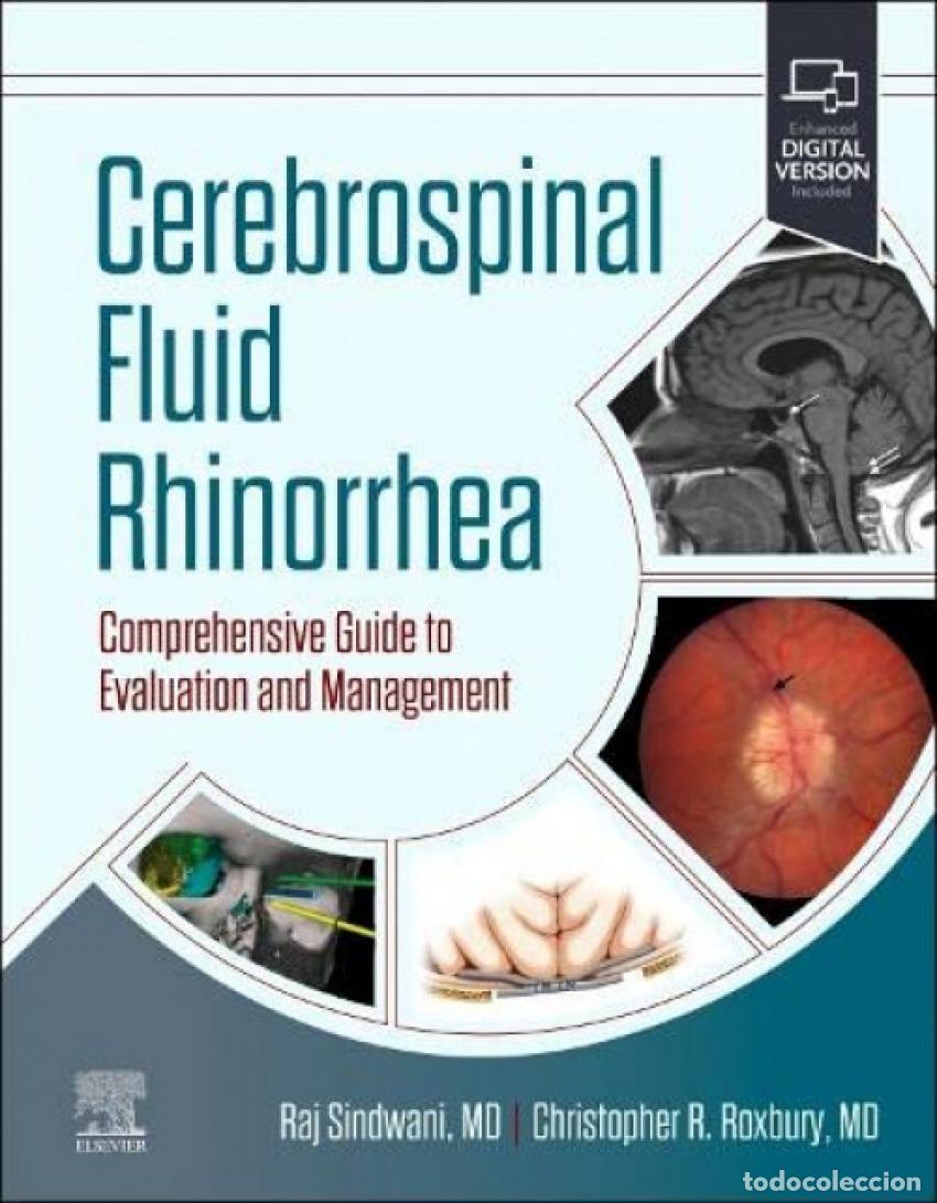 Libri: CEREBROSPINAL FLUID RHINORRHEA - Sindwani