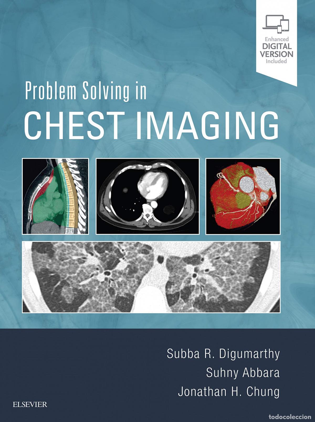 Livros: PROBLEM SOLVING IN CHEST IMAGING - Digumarthy