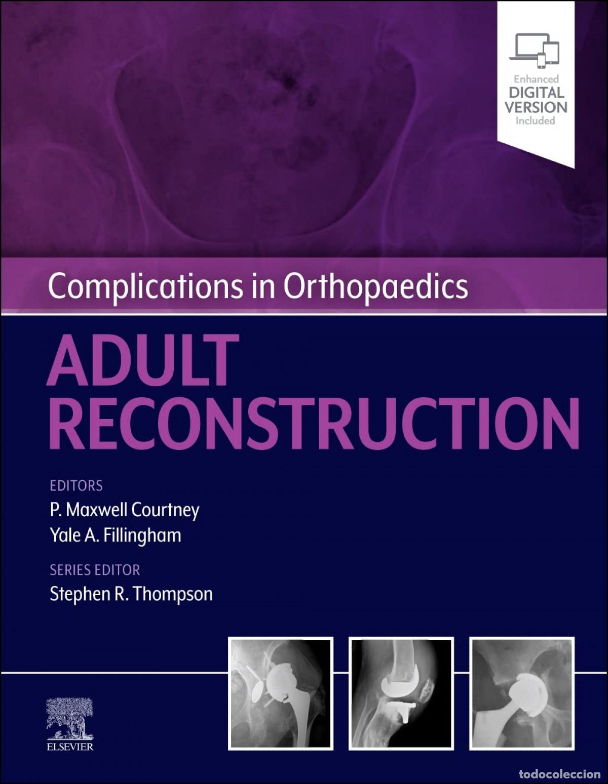 Libros: COMPLICATIONS IN ORTHOPAEDICS: ADULT RECONSTRUCTION - Courtney