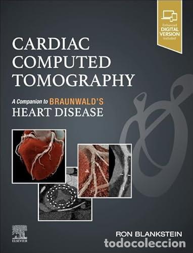 Libros: CARDIAC COMPUTED TOMOGRAPHY:A COMPANION BRAUNWALD&acute;S - Blanksten