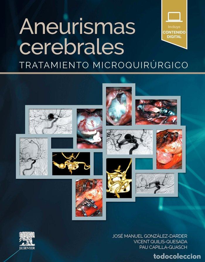 Libros: ANEURISMAS CEREBRALES - AA.VV.