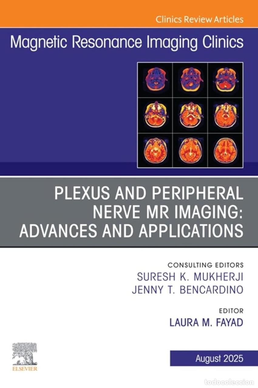 Libri: PLEXUS AND PERIPHERAL NERVE MR IMAGING:ADVANCES - AA.VV.