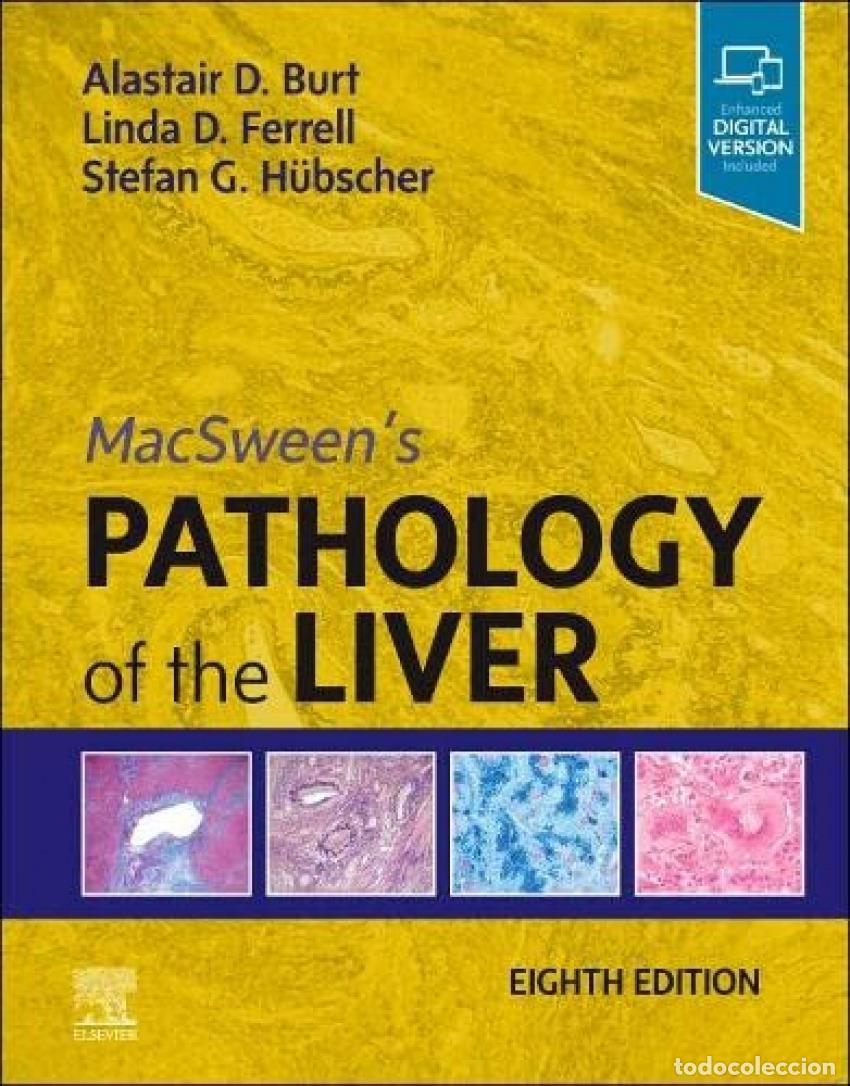 Livros: MACSWEEN&acute;S PATHOLOGY OF LIVER - Burt