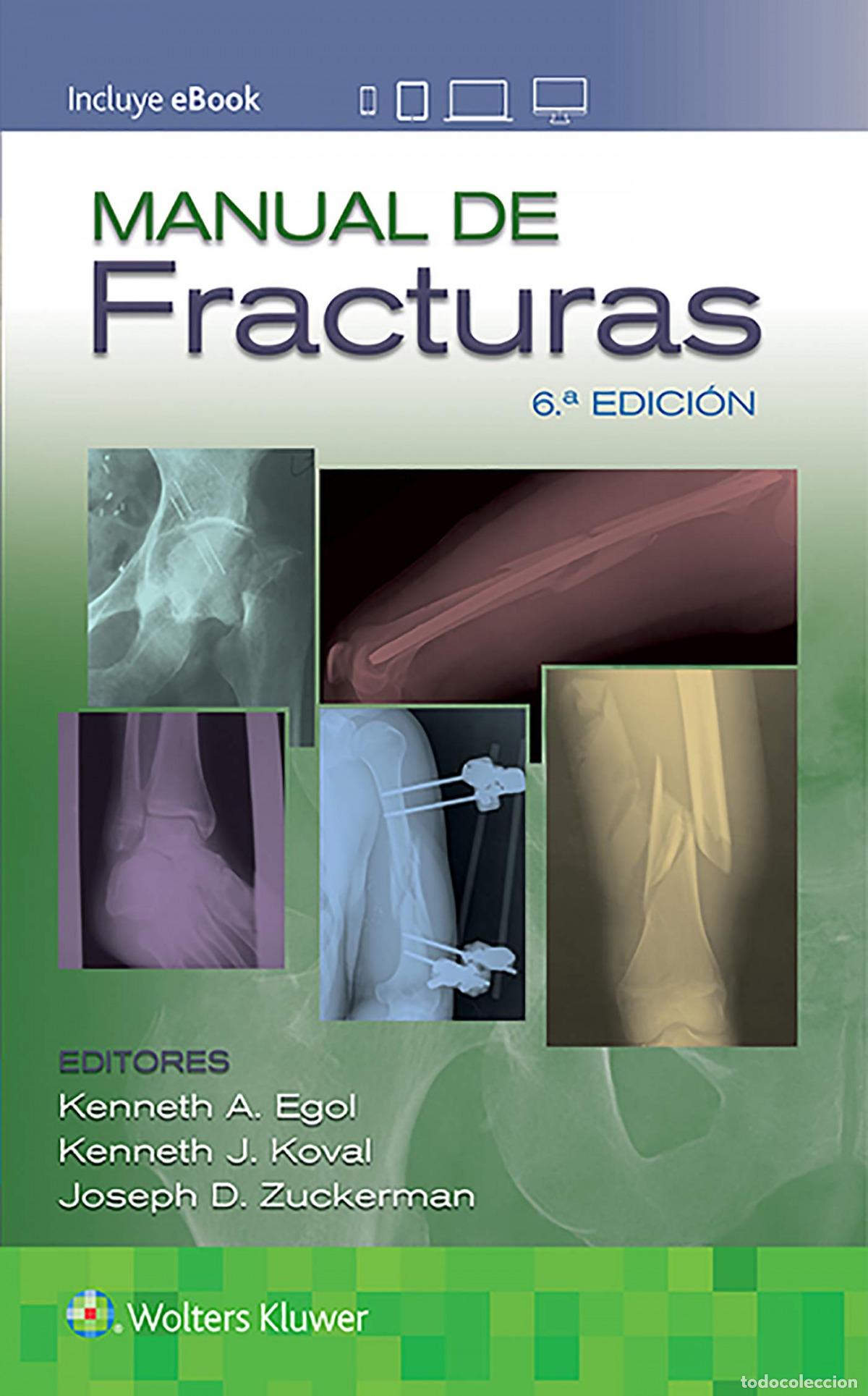 B&uuml;cher: MANUAL DE FRACTURAS 6&ordm;ED - EGOL