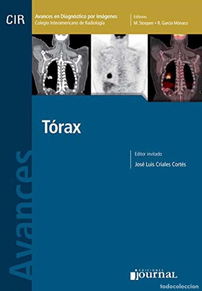 Libri: AVANCES EN DIAGN&Oacute;STICO POR IM&Aacute;GENES. T&Oacute;RAX - VV.AA.