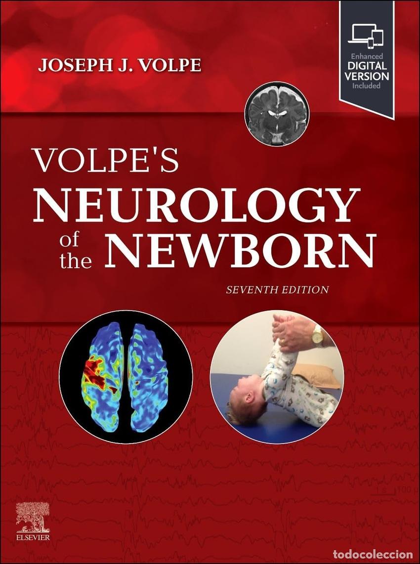 Libros: VOLPE&acute;S NEUROLOGY OF THE NEWBORN - Volpe