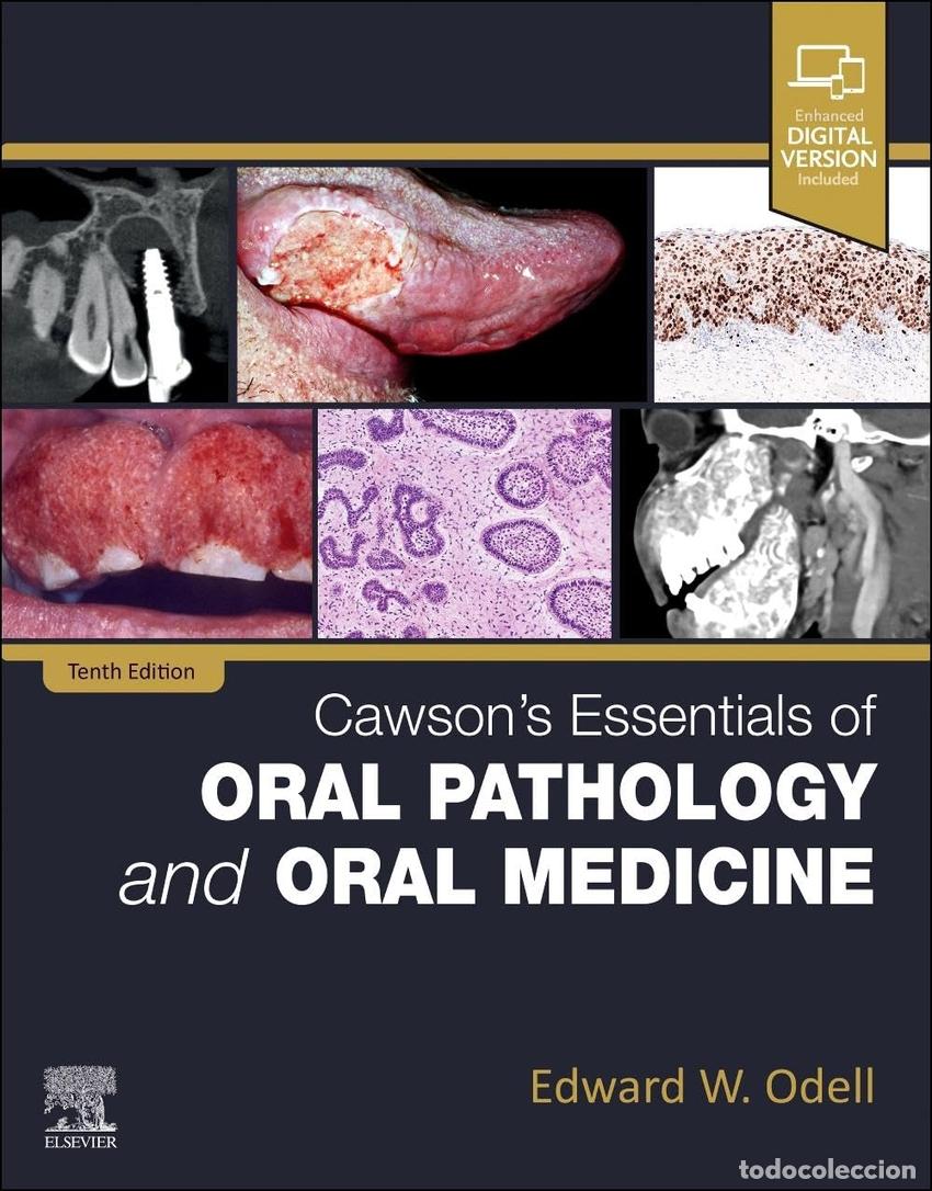 Libros: CAWSON&acute;S ESSENTIALS OF ORAL PATHOLOGY AND ORAL MEDICINE - Odell