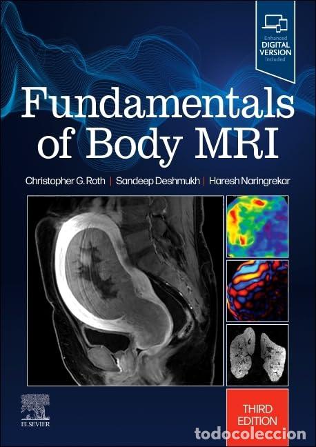 Libri: FUNDAMENTALS OF BODY MRI - AA.VV.