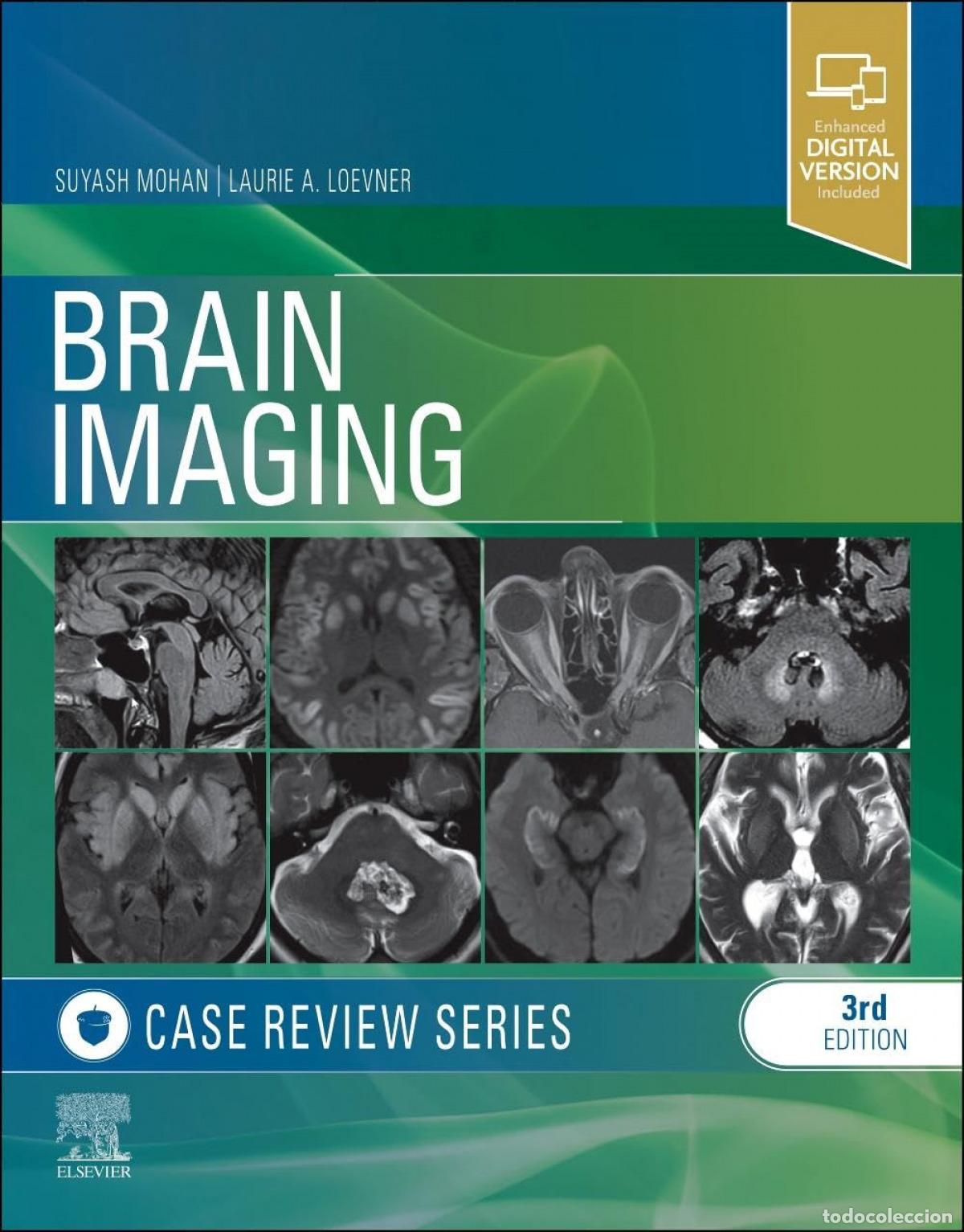 Libros: BRAIN IMAGING:CASE REVIEW SERIES - Mohan, Suyash