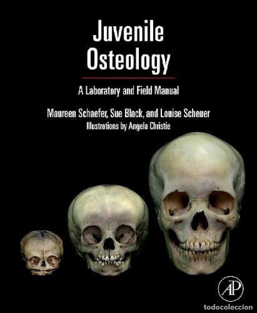 Libri: JUVENILE OSTEOLOGY - Scheuer, Louise