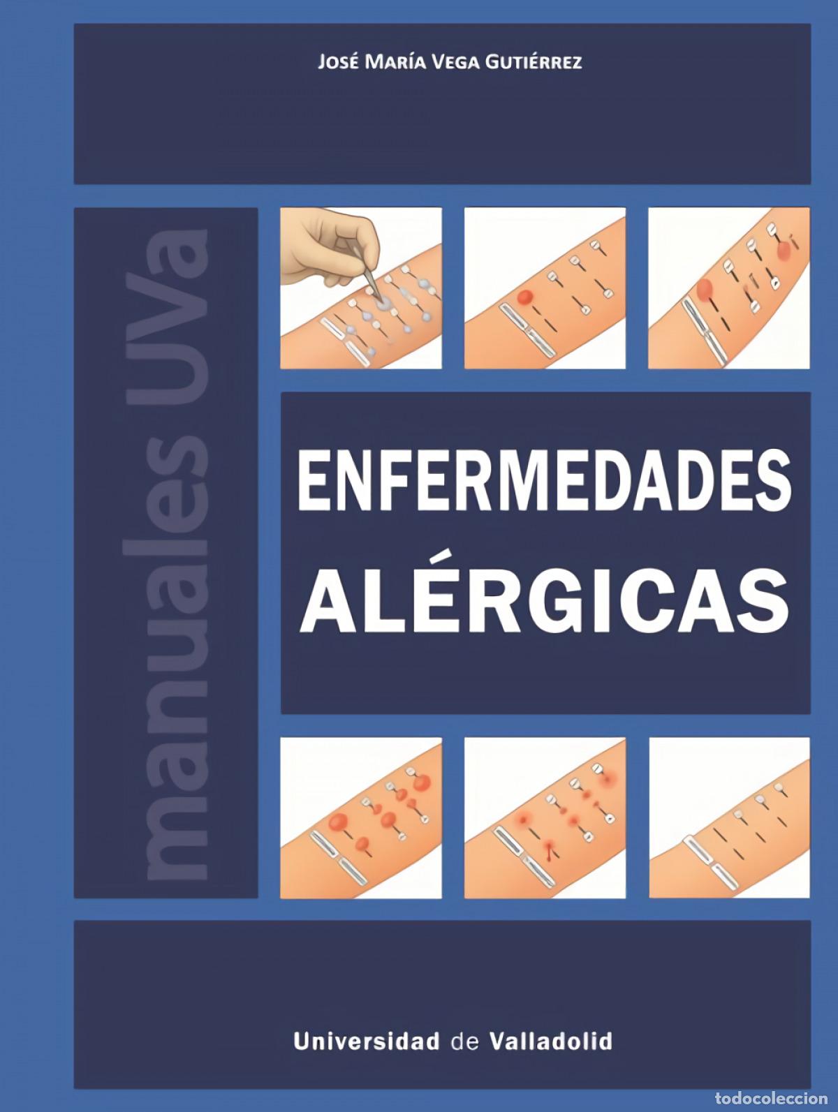 Livres: ENFERMEDADES AL&Eacute;RGICAS - Vega Guti&eacute;rrez, Jos&eacute; Mar&iacute;a