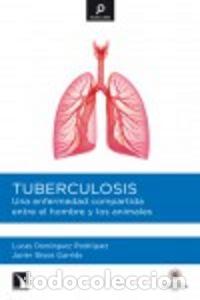 books: TUBERCULOSIS - DOMINGUEZ RODRIGUEZ, LUCAS ALBERTO