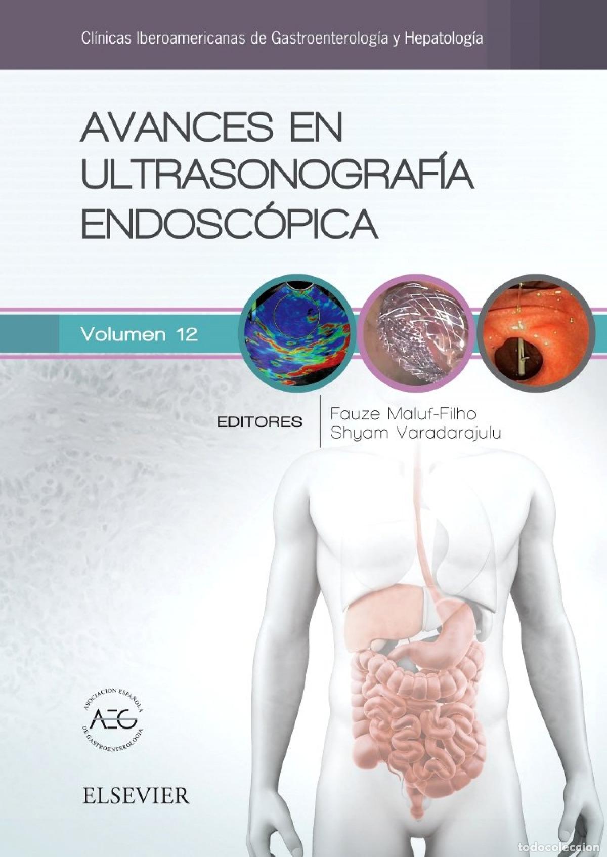 books: AVANCES EN ULTRASONOGRAF&Iacute;A ENDOSC&Oacute;PICA - VV.AA.