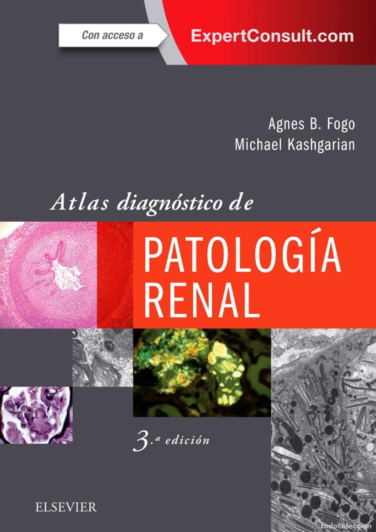 books: ATLAS DIAGN&Oacute;STICO DE PATOLOG&Iacute;A RENAL - Fogo, Agnes
